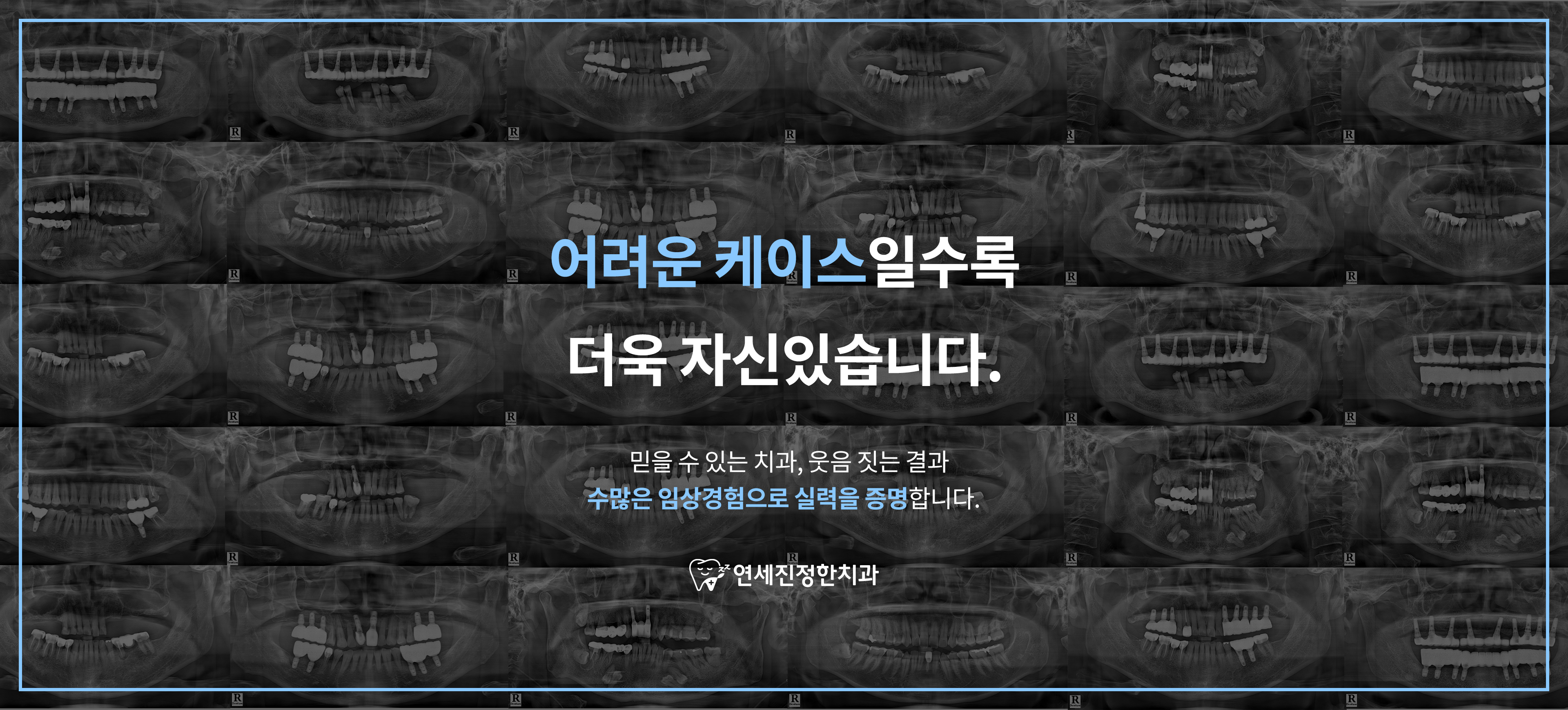 어려운 케이스 자신있습니다